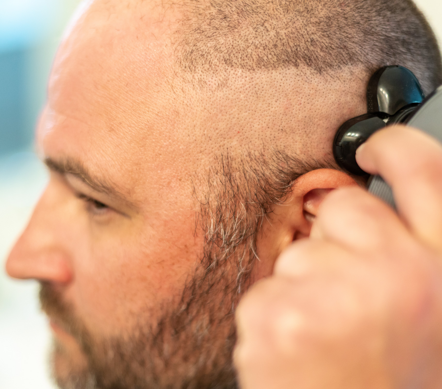 Effortless Head Shaving: GlideX® 7D 5-in-1 Head Shaver Kit (VAT Incl.)