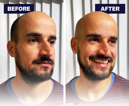 Effortless Head Shaving: GlideX® 7D 5-in-1 Head Shaver Kit (VAT Incl.)